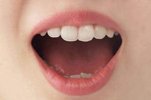 ハッピーリフトで、お悩み解決できます。